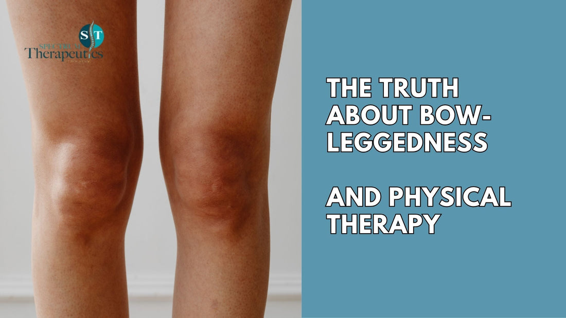 Physical therapist guiding a patient with bow-leggedness through hip and leg strengthening exercises.